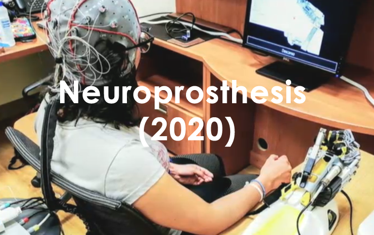 Neuroprótesis2020